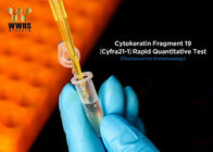 Cytokeratin 19 POCT Test Kit Fragment High Accuracy CK19 FIA Colloidal Gold Diagnostic